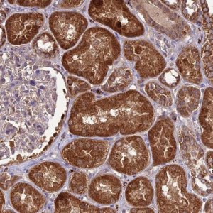 Anti-NDUFAF1 antibody produced in rabbit 