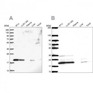 Anti-NDUFAF2 antibody produced in rabbit 