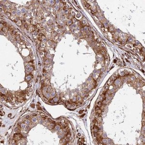 Anti-NDUFAF7 antibody produced in rabbit 