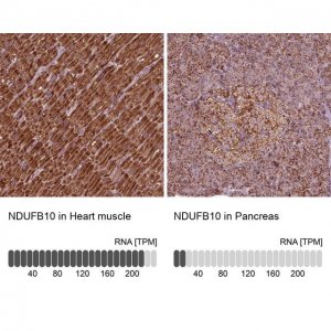 Anti-NDUFB10 antibody produced in rabbit 