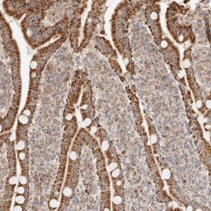 Anti-NDUFB11 antibody produced in rabbit 