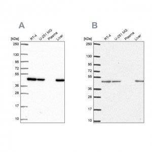 Anti-NDUFS2 antibody produced in rabbit 