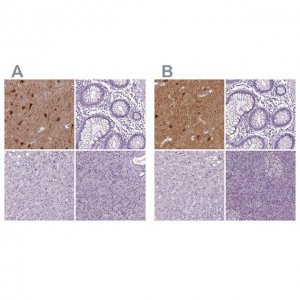 Anti-NECAB1 antibody produced in rabbit 