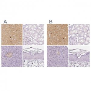 Anti-NECAB2 antibody produced in rabbit 