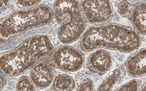 Anti-Nectin-2/CD112 Antibody, clone 2H6 ZooMAb Rabbit Monoclonal 