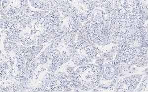Anti-Nectin-2/CD112 Antibody, clone 2H6 ZooMAb Rabbit Monoclonal 