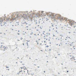 Anti-NECTIN4 antibody produced in rabbit 