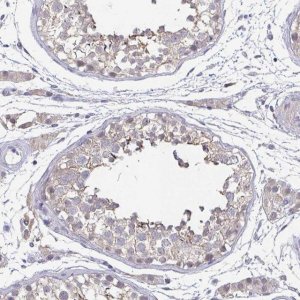 Anti-NEFH antibody produced in rabbit 