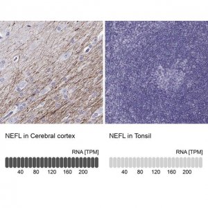 Anti-NEFL antibody produced in rabbit 