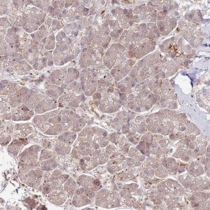 Anti-NEK3 antibody produced in rabbit 