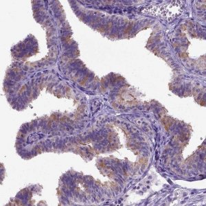 Anti-NEK5 antibody produced in rabbit 