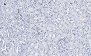Anti-Nestin Antibody, clone 8B8, ZooMAb Rabbit Monoclonal 