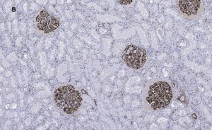 Anti-Nestin Antibody, clone 8B8, ZooMAb Rabbit Monoclonal 