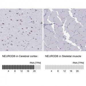 Anti-NEUROD6 