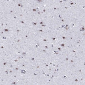 Anti-NEUROD6 