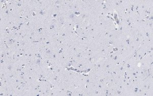 Anti-Neurofilament H Antibody, clone 5L10, ZooMAb Rabbit Monoclonal 