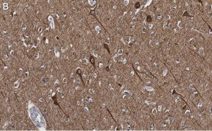 Anti-Neurofilament H Antibody, clone 5L10, ZooMAb Rabbit Monoclonal 
