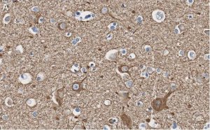 Anti-Neurofilament L Antibody, clone 1E13 ZooMAb Rabbit Monoclonal 