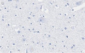 Anti-Neurofilament L Antibody, clone 1E13 ZooMAb Rabbit Monoclonal 