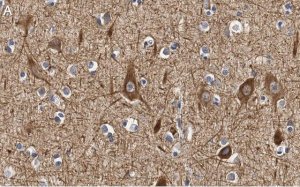 Anti-Neurofilament M Antibody, clone 1B23 ZooMAb Rabbit Monoclonal 