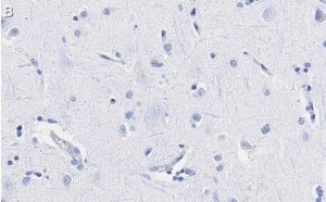 Anti-Neurofilament M Antibody, clone 1B23 ZooMAb Rabbit Monoclonal 