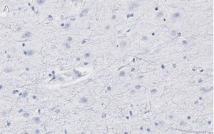 Anti-Neurogranin Antibody, clone 1D4 , ZooMAb Rabbit Monoclonal 