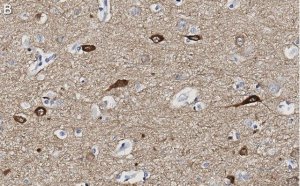 Anti-Neurogranin Antibody, clone 1D4 , ZooMAb Rabbit Monoclonal 