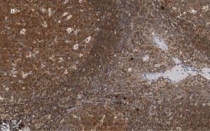 Anti-NF-kB p50/105 Antibody, clone 1N19, ZooMAb Rabbit Monoclonal 