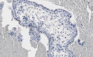 Anti-NF-kB p65 subunit Antibody, clone 1D8 ZooMAb Rabbit Monoclonal 