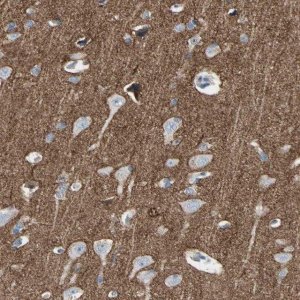 Anti-NFASC antibody produced in rabbit 