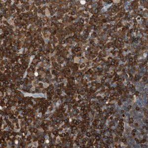 Anti-NFATC2 antibody produced in rabbit 