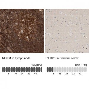Anti-NFKB1 antibody produced in rabbit 