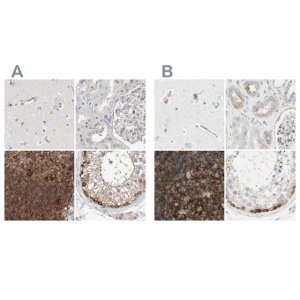 Anti-NFKB2 antibody produced in rabbit HPA023900-100UL