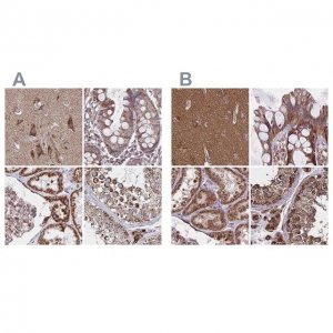 Anti-NFS1 antibody produced in rabbit 