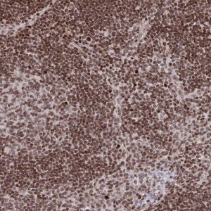 Anti-NIP7 antibody produced in rabbit HPA059850-100UL