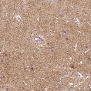Anti-NLGN2 antibody produced in rabbit 