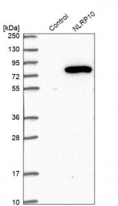 Anti-NLRP10 antibody produced in rabbit HPA039498-100UL