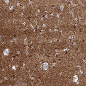 Anti-NLRP10 antibody produced in rabbit HPA039498-100UL