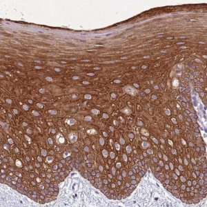 Anti-NLRP11 antibody produced in rabbit 