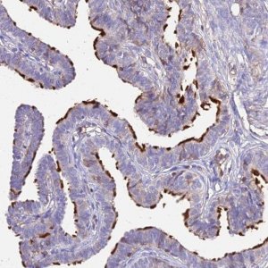 Anti-NME5 antibody produced in rabbit 