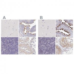 Anti-NME9 antibody produced in rabbit 