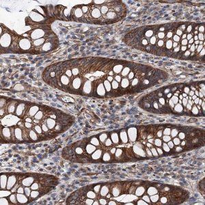 Anti-NMRAL1 antibody produced in rabbit HPA041353-100UL