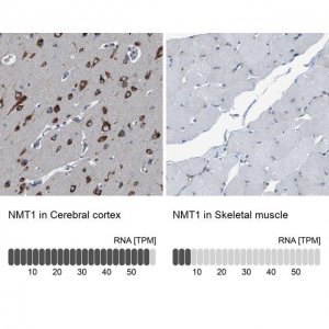 Anti-NMT1 antibody produced in rabbit 
