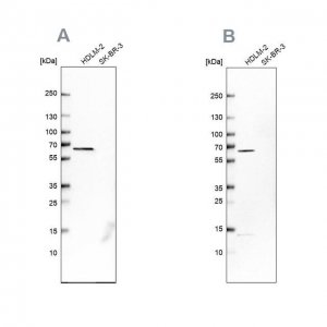 Anti-NMT1 antibody produced in rabbit 