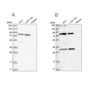 Anti-NOA1 antibody produced in rabbit 