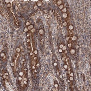 Anti-NOA1 antibody produced in rabbit 