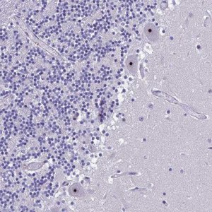 Anti-NOC2L antibody produced in rabbit 