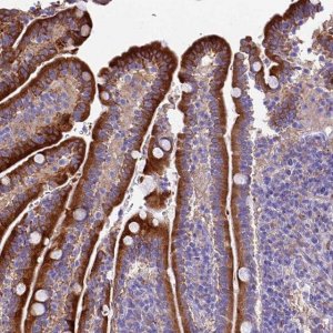 Anti-NOD2 antibody produced in rabbit 