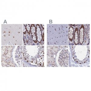 Anti-NOL4L antibody produced in rabbit 
