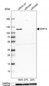 Anti-NOP14 antibody produced in rabbit 